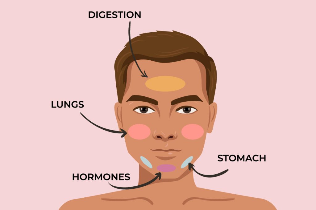 Acne Treatment