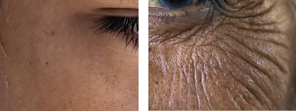 Anti Aging Consultation