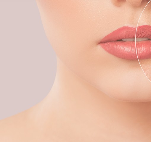 acne after